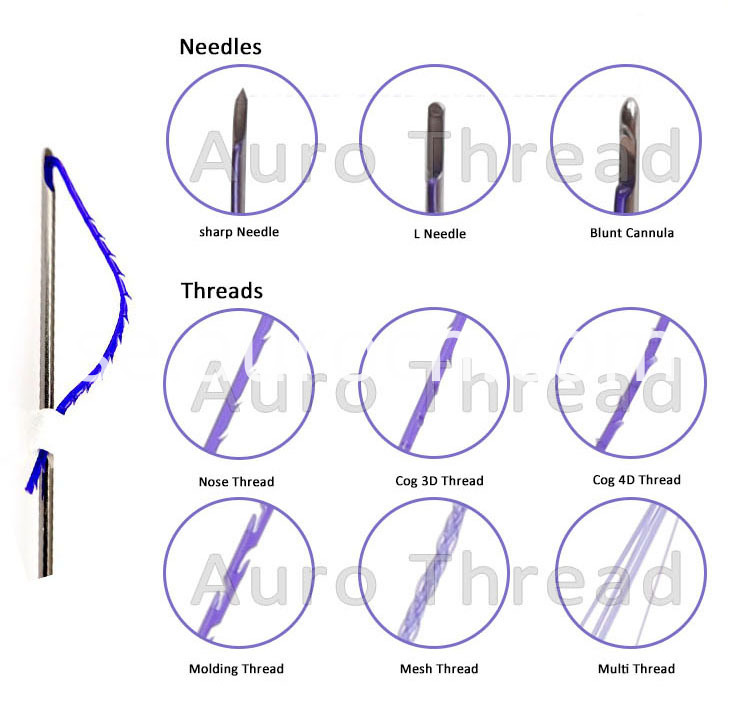 Trådliftfördel Thread face lift advantage